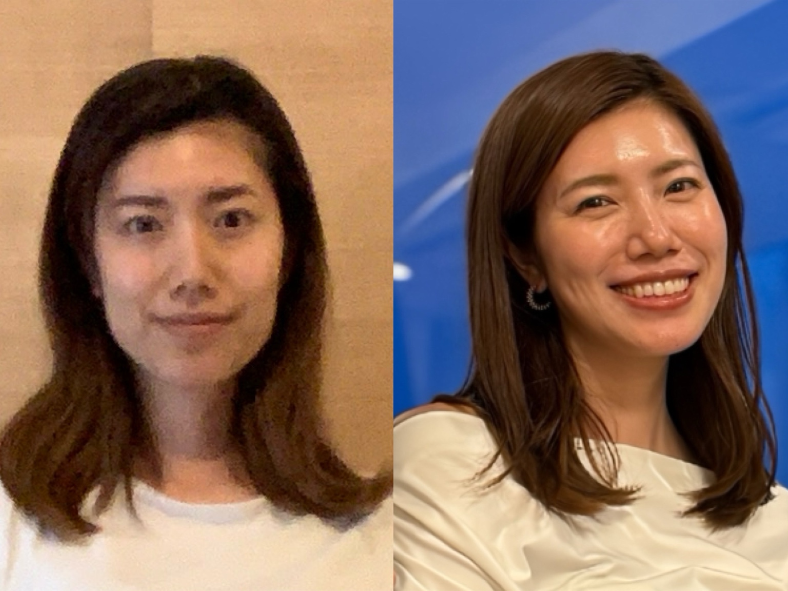 斉藤玲奈本人の顔のBefore・After